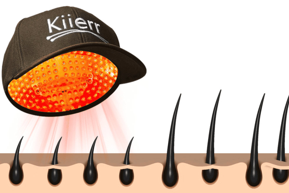 10 Most FAQ s About Hair Loss And LLLT Low Level Light Therapy 10-most-faq-s-about-hair-loss-and-lllt-low-level-light-therapy