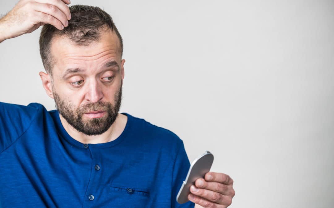 Balding Hairstyles for Men