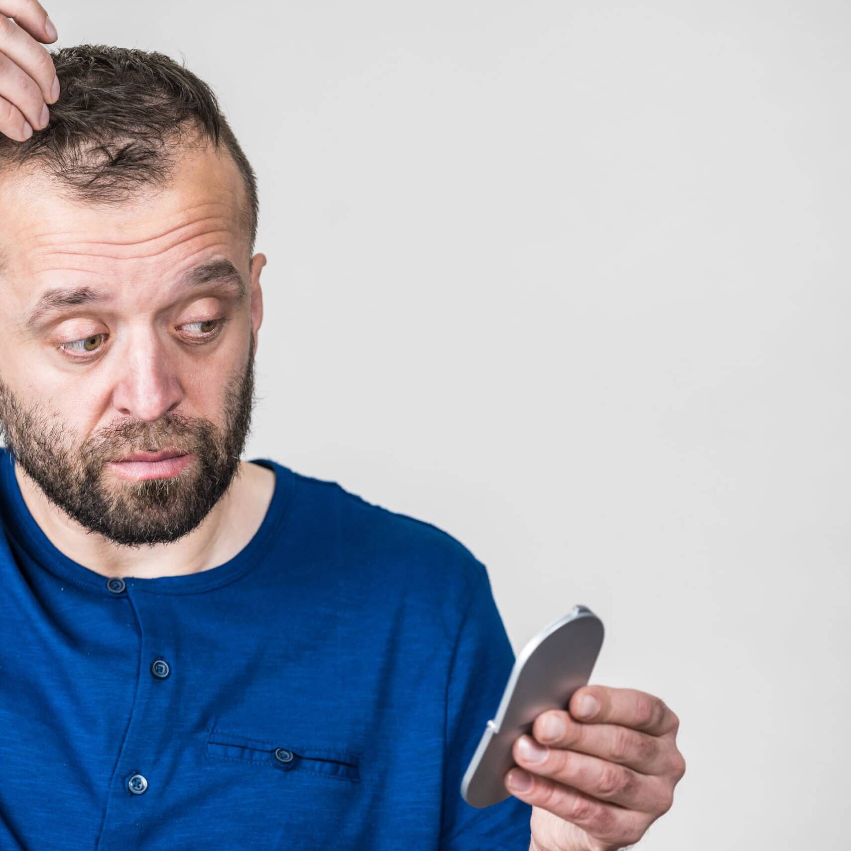 Balding Hairstyles for Men - Kiierr Laser Hair Caps - Hair Growth Experts, image size:1709x1709