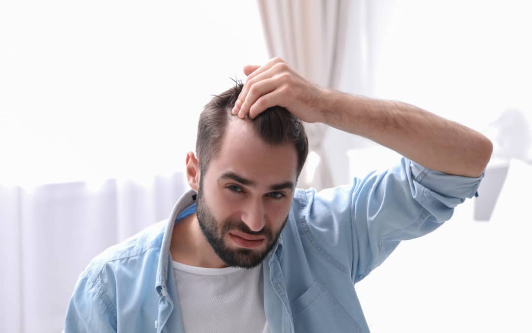 Combating a Receding Hairline — Causes, Symptoms, and Treatments