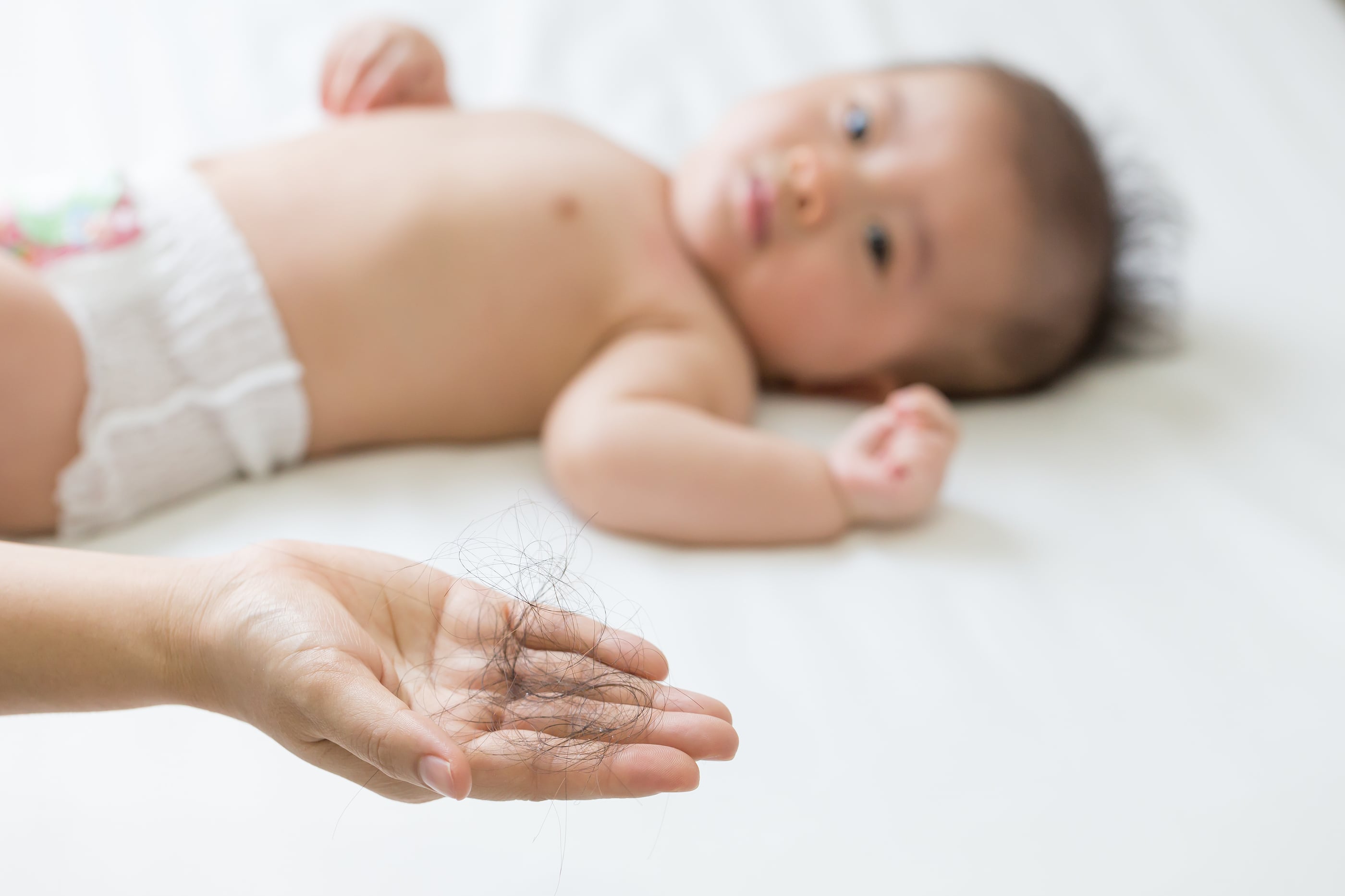 Postpartum Hair Loss The Ultimate Treatment Guide 2020 Findings