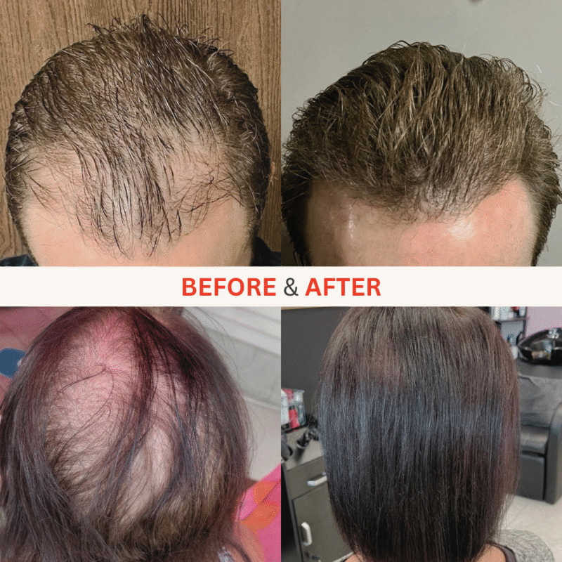 272 MD Elite Laser Hair Cap - Ultimate MAX Growth Bundle - Image 5