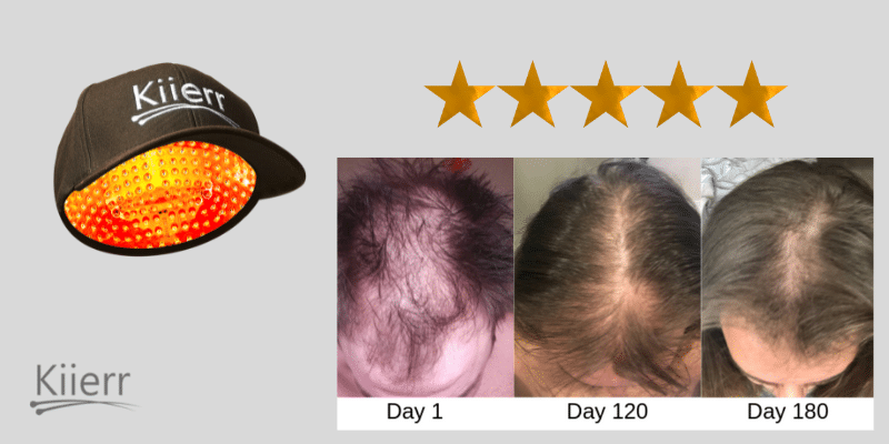 Low level laser therapy for hair growth 