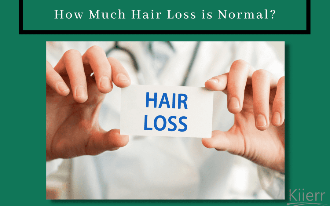 How Much Hair Loss is Normal?