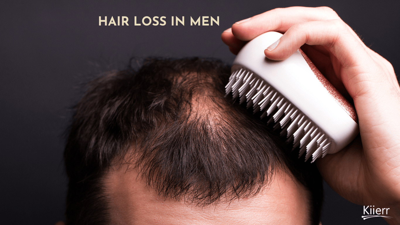 Hair Loss in Men Why it Happens and What You Can Do About It Kiierr