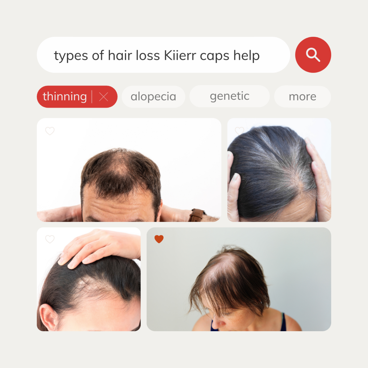 Top 5 Reasons Kiierr Laser Hair Caps Hair Growth Experts