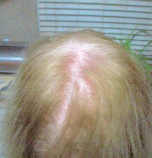 cw-before-image1