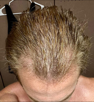 cw-before-image2