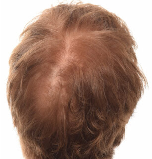 cw-before-image3