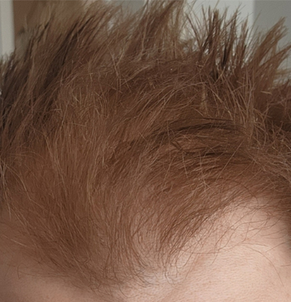 cw-after-image13