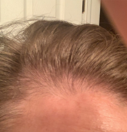cw-before-image10