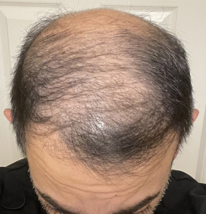 cw-before-image11