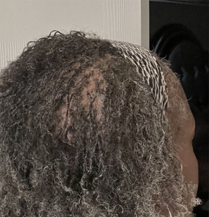 cw-before-image12