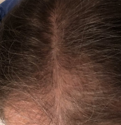 cw-before-image14