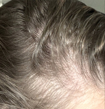 cw-before-image15