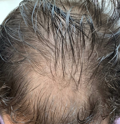 cw-before-image16