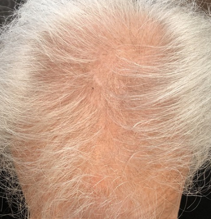 cw-before-image17
