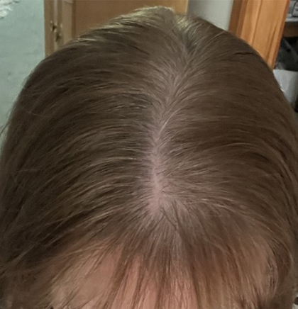 cw-before-image18