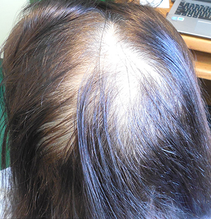 cw-before-image4