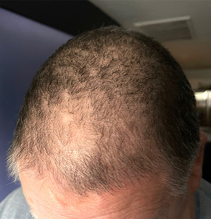 cw-before-image5