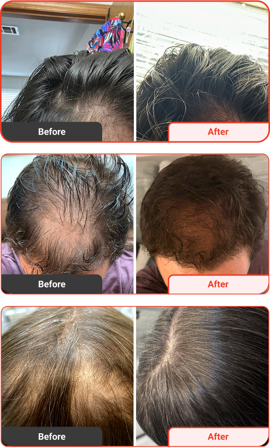 Transformation Grid