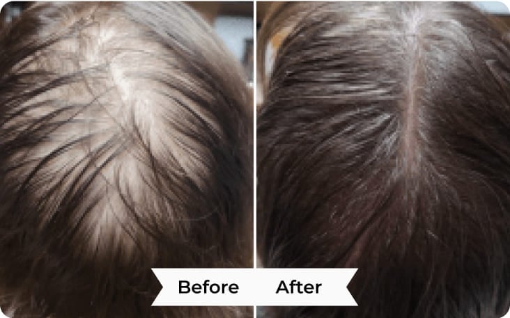 After Before Image