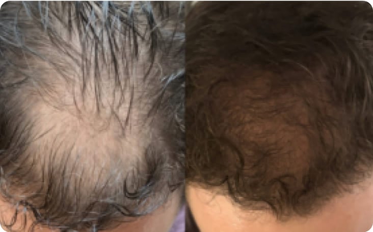 After Before Image