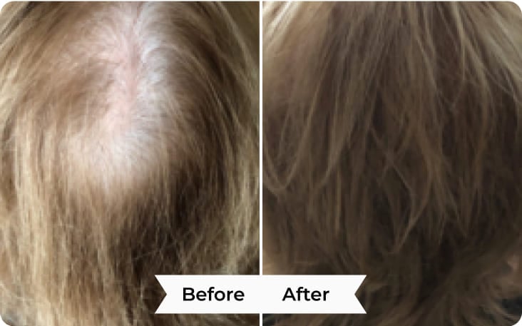 After Before Image