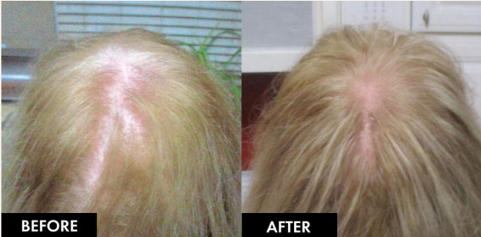 B&A-3