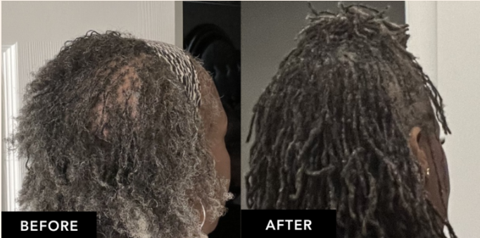 B&A-4