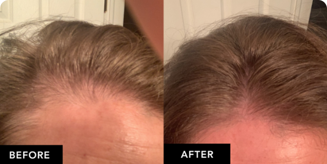 B&A-7