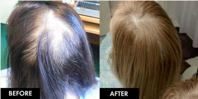 Marsha B&A