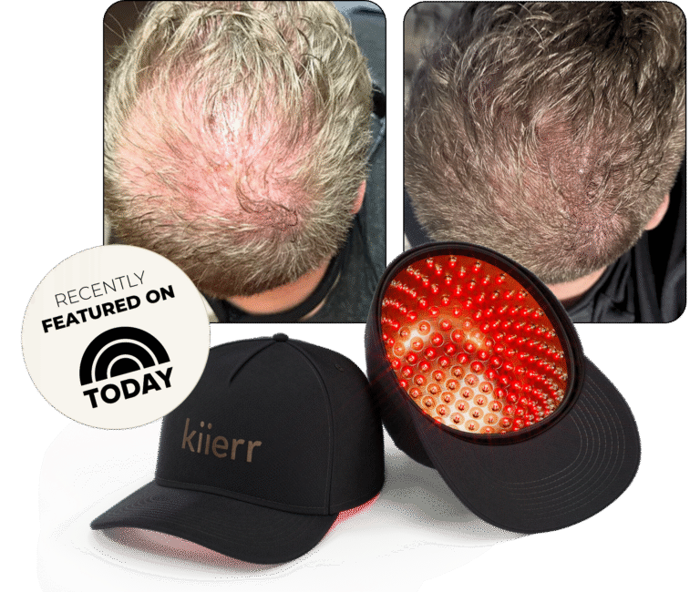 Laser Cap Before and After
