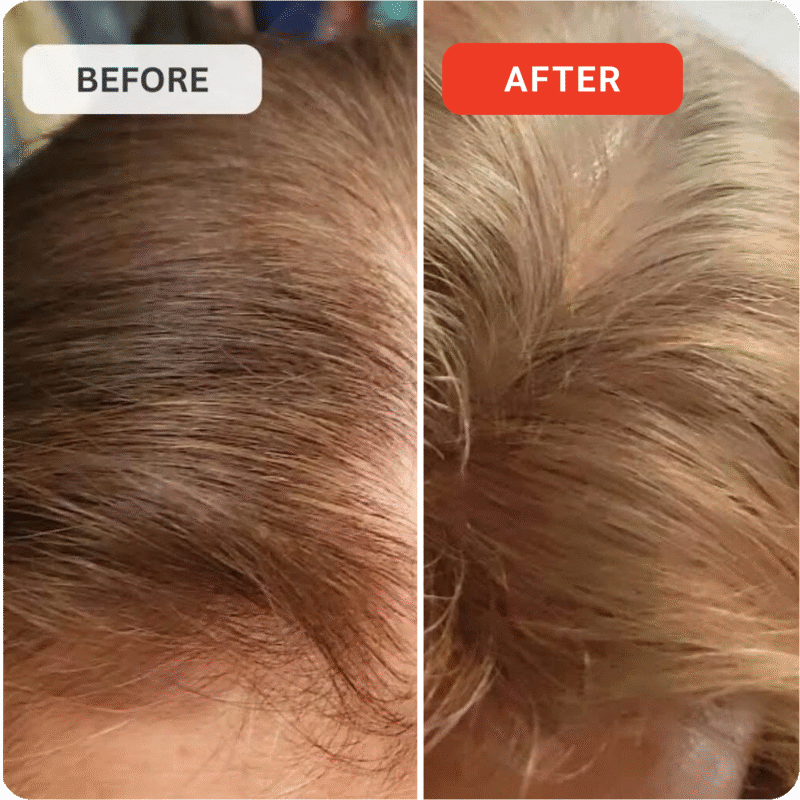 Kiierr Laser Cap Hair Growth System new design - Image 4