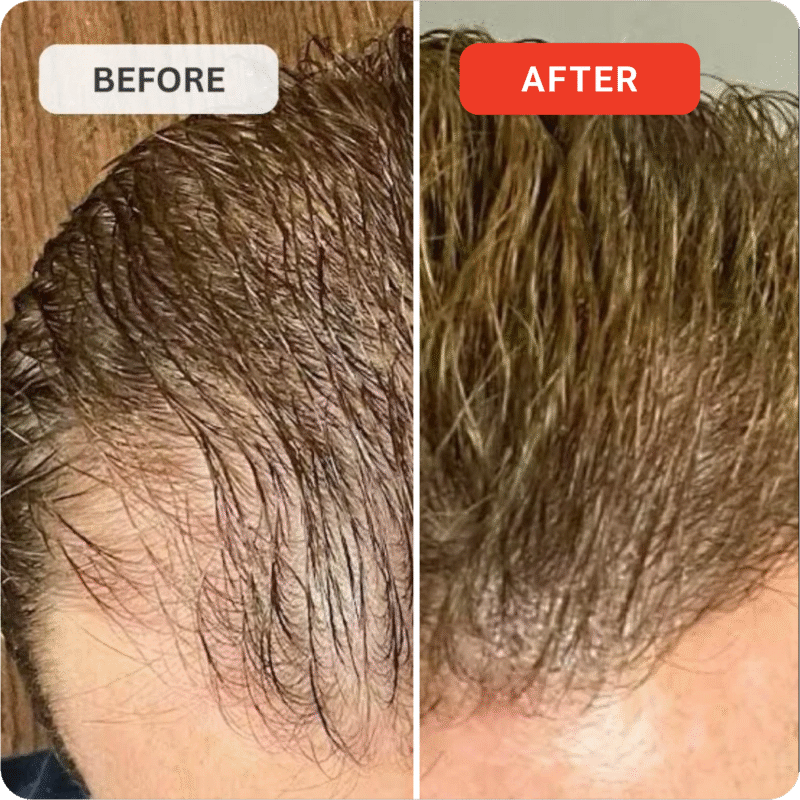 Kiierr Laser Cap Hair Growth System new design - Image 8
