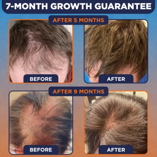 Kiierr's 7-Month Growth Guarantee with Before After Photos