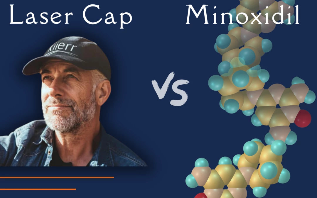 Laser Cap vs. Minoxidil
