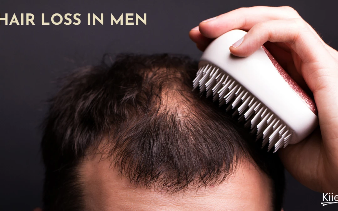 Hair Loss in Men: Why it Happens and What You Can Do About It